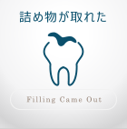 詰め物が取れた